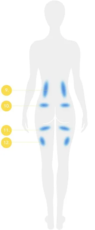 CoolSculpting fat freezing London - back body diagram with numbered treatable fat areas Back body diagram with numbered treatable fat areas for CoolSculpting fat freezing in London