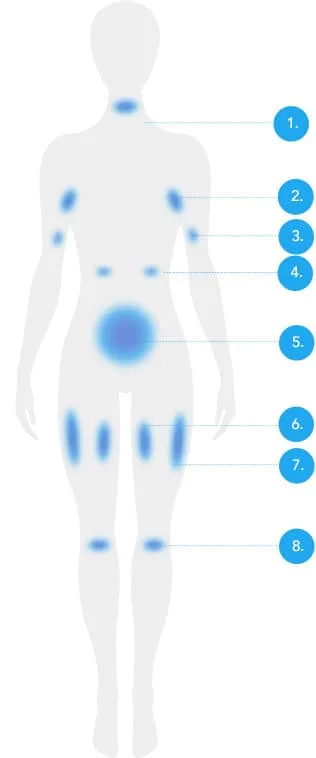 CoolSculpting fat freezing London - front body diagram with numbered treatable fat areas Front body diagram with numbered treatable fat areas for CoolSculpting fat freezing in London
